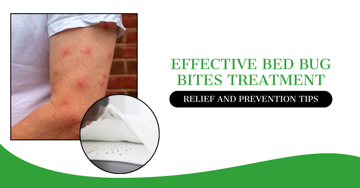 Effective Bed Bug Bites Treatment: Relief and Prevention Tips